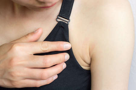 Close-up of woman worry about her underarm 'chicken skin'. Problem of armpit skin.の写真素材