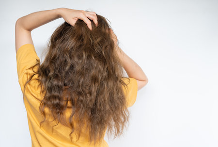 Rear view of young woman while scratching her scalp caused of itchy scalp. Dandruff and an...