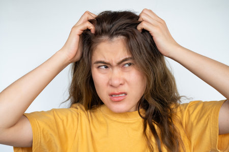 Asian woman scratching her scalp caused of itchy scalp. Dandruff and an inflammatory skin condition called seborrheic dermatitis are the most common causes of itchy scalp.の写真素材