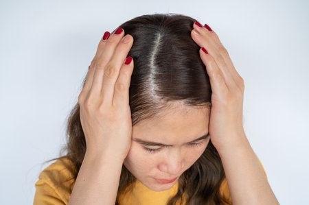 Close up of Asian woman showing her forehead with part of her thin hair, she had hair loss problem. Female pattern hair loss can progress from a widening part to overall thinning.の写真素材