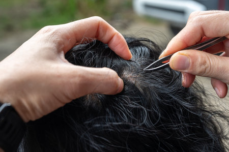 Cropped shot view of someone using a tweezers for gripping and plucking gray hair from woman head....