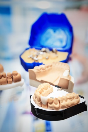 various samples of casts of dentures, close upの写真素材