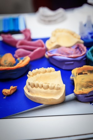 various samples of casts of dentures, close upの写真素材
