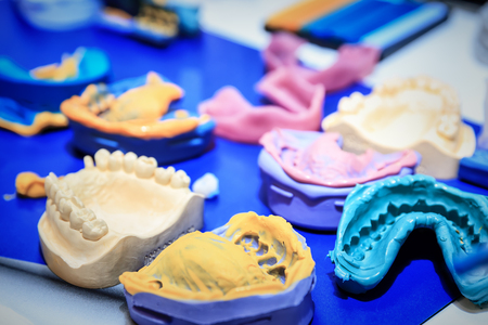 various samples of casts of dentures, close upの写真素材