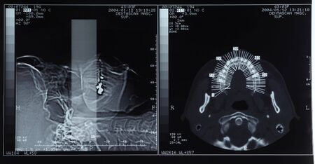 dental scan radiography