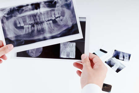 Panoramic dental x-ray image of teeth. Dentistの写真素材