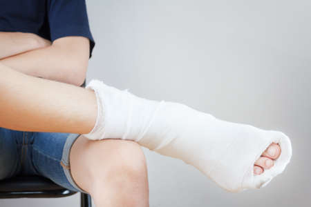 Man with broken leg in a plaster sits on chair white backgroundの写真素材