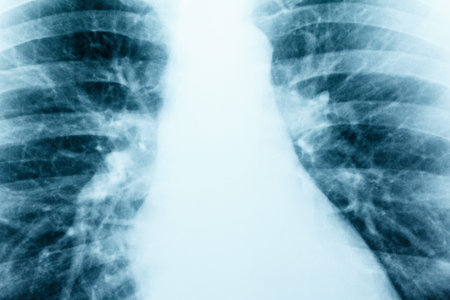 X-Ray Image. Human ribs of the chest, MRI photo of bones close-up