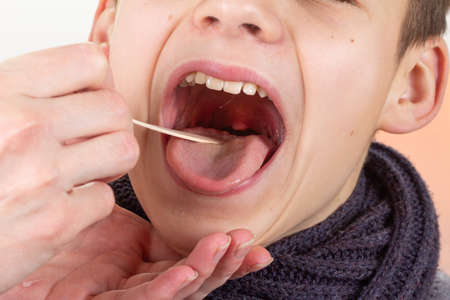Child boy throat doctor medical check health,  flu.の写真素材