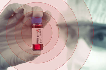 Coronavirus research laboratory, doctor with blood diagnostic covid-19, hospital.の写真素材