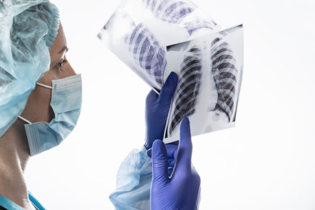 Lung x-ray covid-19 hospital medical doctor coronavirus, health pandemic.