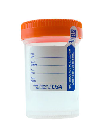 Urine sample bottle isolated on white