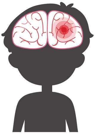 Body silhouette with brain has a red signal illustrationのイラスト素材