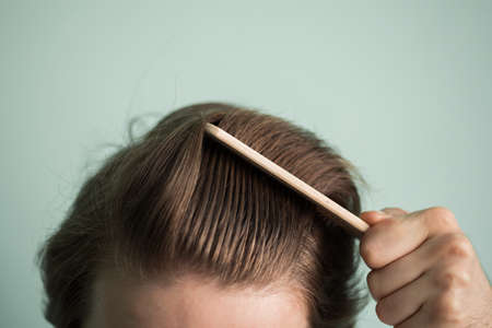 man with healthy hair holding comb. clean healthy man's hair without furfurの写真素材