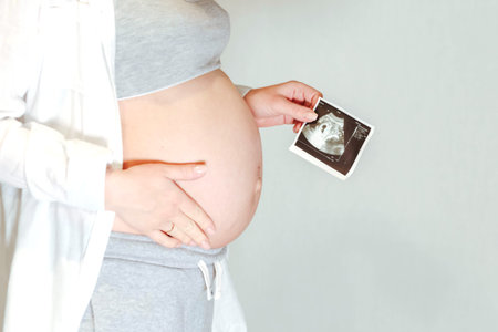 Pregnant woman holding ultrasound image. Concept of pregnancy, health care, gynecology, medicine....
