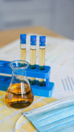 Flask and test tubes with urine on medical color schemes. The concept of laboratory analyzes, ph...