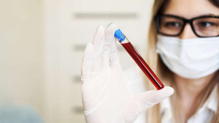 Female scientist holding test tube with blood sample. The concept of analyzes and diagnostics of viruses and diseases. Focus on the test tubeの写真素材