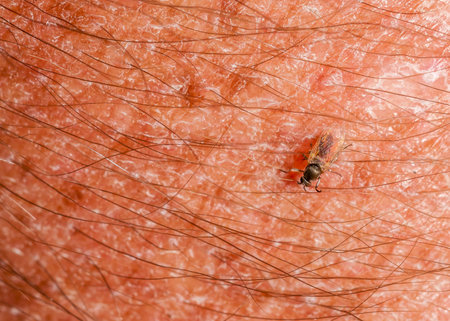 Gnat Biting Arm closeup demonstrating how they are.