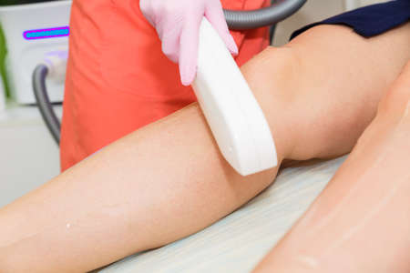 Hair removal with laser hair removal. Hair removal on legs laser hair removal.の写真素材