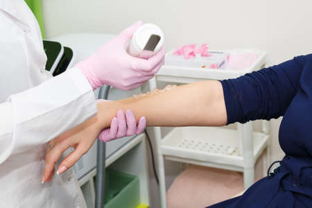 The cosmetologist applies contact gel to the skin of the hand before laser hair removal.の写真素材
