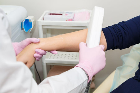 Hair depilation in the beauty salon. Laser hair removal on the arm.