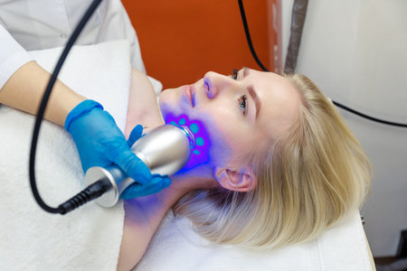 Hardware rejuvenation of the skin of the face and correction of the shape of the face.の写真素材