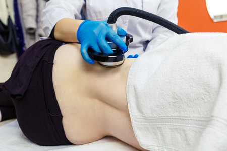 Radiofrequency hardware procedures for weight loss in a beauty salon.