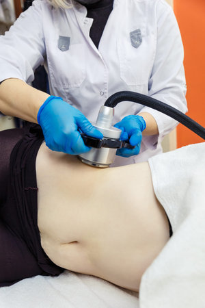Radiofrequency lifting of the abdomen and lateral parts. Anti-cellulite massage with cavitation and...