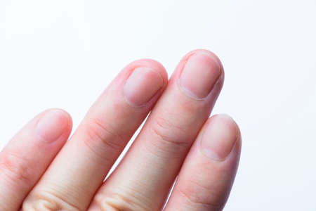 Closeup of man finger nail on white backgroundの写真素材