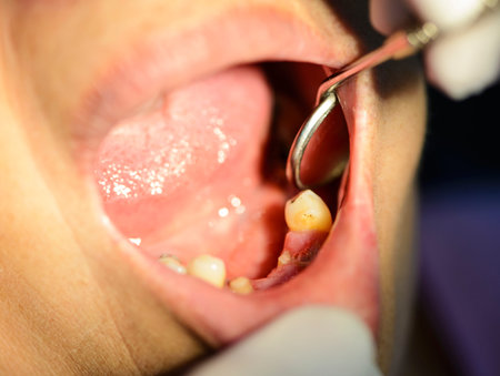 Macro shot of dentist checking a broken teeth