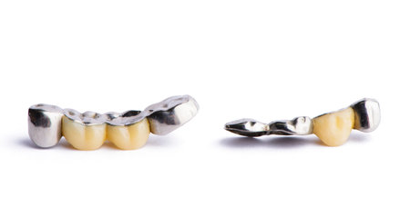 Ceramic dentures. Isolated on white background.