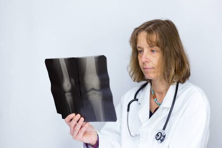 European female doctor looking at xray photo
