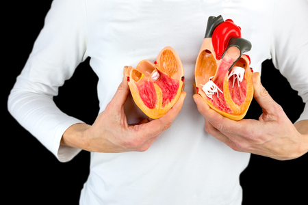 Woman holding open human heart model at white bodyの写真素材