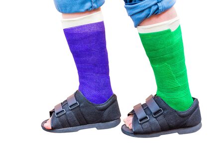 Two standing colored gypsum legs with shoes isolated on white backgroundの写真素材