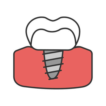 Dental implant color icon. Endosseous implant. Isolated vector illustrationのイラスト素材
