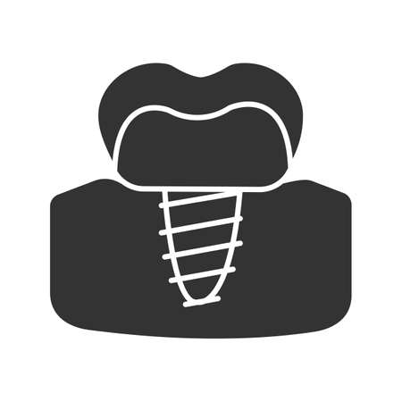 Dental implant glyph icon. Endosseous implant. Silhouette symbol. Negative space. Vector isolated illustrationのイラスト素材