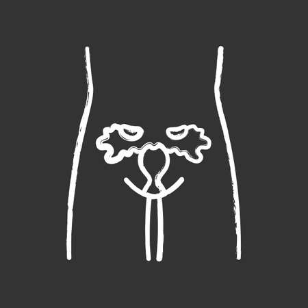 Ill women reproductive system chalk icon.Infertility. Sore human organ.  Uterus disease. Sick internal body part. Women health. Isolated vector chalkboard illustrationのイラスト素材
