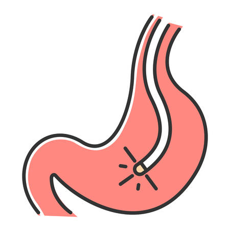 Endoscopy color icon. Gastroscopy process. Medical nonsurgical procedure. Healthcare services. Professional clinical treatment. Disease diagnostics. Visual inspection. Isolated vector illustrationのイラスト素材