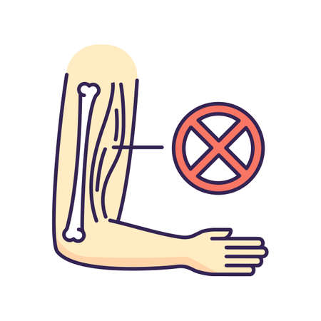 Muscular dystrophy RGB color icon. Chronic genetic disorder. Tissue damage in human arm. Patient with medical diagnosis. Health care problem. Weakness in hand. Isolated vector illustrationのイラスト素材