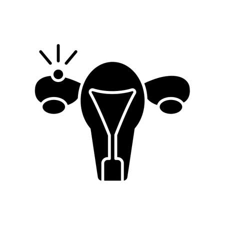 Ectopic pregnancy black glyph icon. Fallopian tube. Embryo outside uterus. Tubal, extrauterine complication. Abdominal pain. Silhouette symbol on white space. Vector isolated illustrationのイラスト素材
