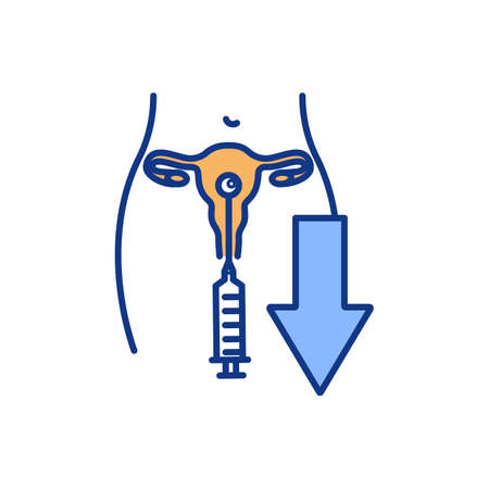 Egg retrieval technique RGB color icon. Vitro fertilization. Egg collection surgical procedure. Transvaginal oocyte retrieval. Ovum pickup. Taking materials from ovaries. Isolated vector illustrationのイラスト素材