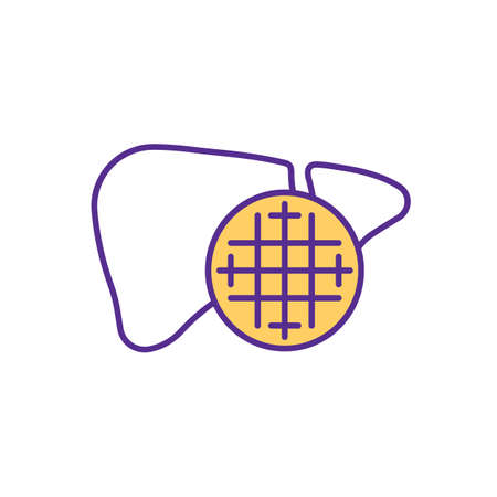 Toxic hepatitis RGB color icon. Harmful substances exposure. Liver inflammation. Chemical-driven damage. Alcohol, drugs negative effects. Hepatotoxicity. Isolated vector illustrationのイラスト素材