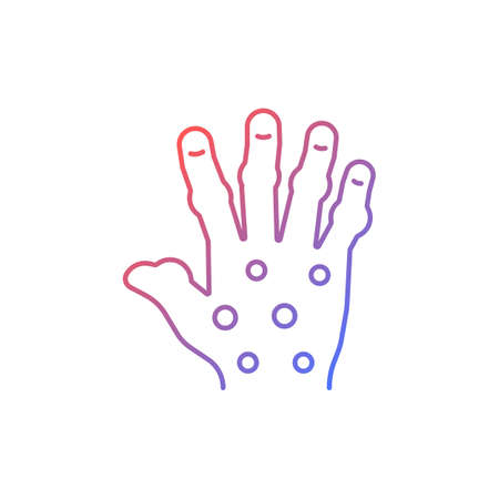 Psoriatic arthritis gradient linear vector icon. Painful hand joints. Permanent bones damage. Fingers deformity. Thin line color symbol. Modern style pictogram. Vector isolated outline drawingのイラスト素材