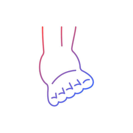 Joint sprain gradient linear vector icon. Ankle ligaments tearing. Sports injury. Overstretched joint. Muscle damage. Thin line color symbol. Modern style pictogram. Vector isolated outline drawingのイラスト素材