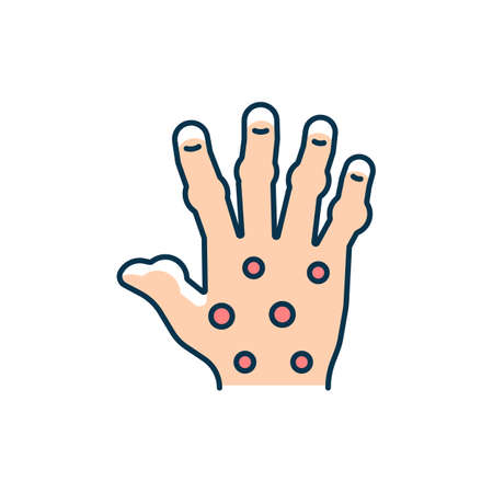 Psoriatic arthritis RGB color icon. Painful finger and hand joints. Permanent bones damage. Chronic inflammatory condition. Fingers deformity. Isolated vector illustration. Simple filled line drawingのイラスト素材