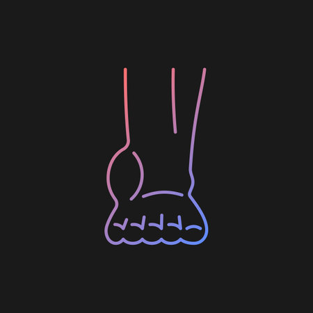 Ankle inflammation gradient vector icon for dark theme. Swollen foot and ankle. Osteoarthritis development. Tendonitis. Thin line color symbol. Modern style pictogram. Vector isolated outline drawingのイラスト素材