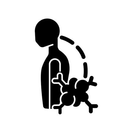 Pathologic scoliosis black glyph icon. Benign bone tumor. Spine sideways deviation. Backbone curvature. Spinal deformation. Silhouette symbol on white space. Vector isolated illustrationのイラスト素材