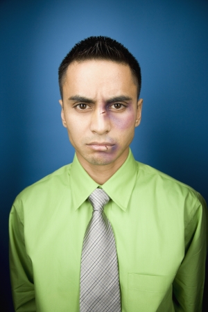 Close up of bruised Hispanic businessmanの写真素材