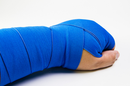 A closeup of a man with a hurt bandaged arm.の写真素材