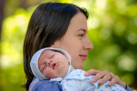 Mother holding newborn baby - with atopic dermatitis - asleep on her shoulder in an outdoor setting, capturing a peaceful and loving moment of maternal care and bonding. Visible red rash on cheeksの写真素材